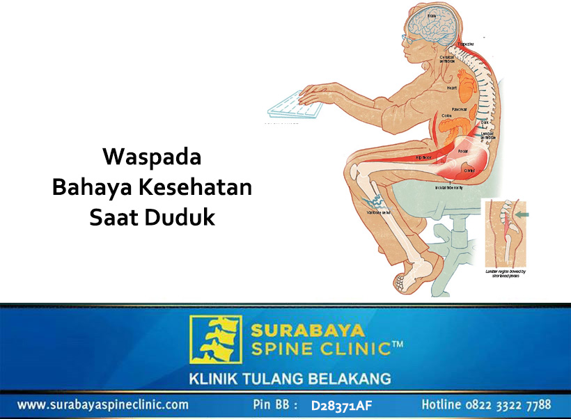 Waspada, Bahaya Kesehatan Saat Duduk